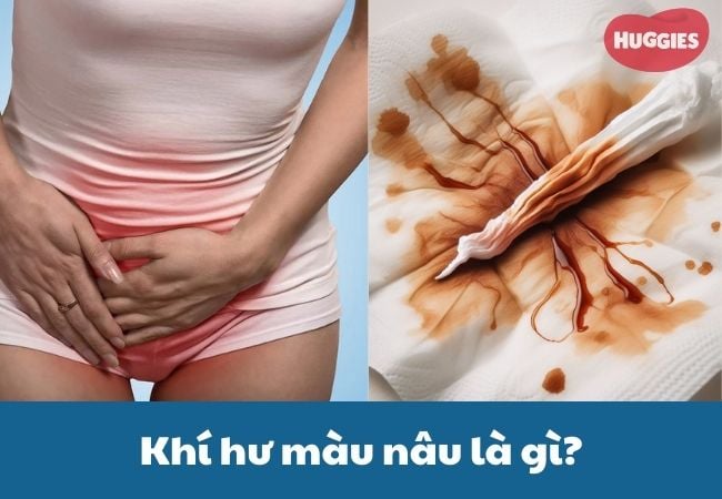 Khí hư màu nâu thường xuất hiện khi gần đến kỳ kinh