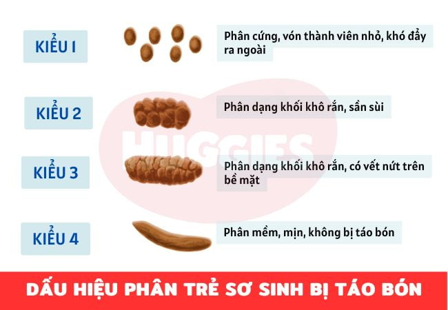 Dấu hiệu phân trẻ sơ sinh bị táo bón