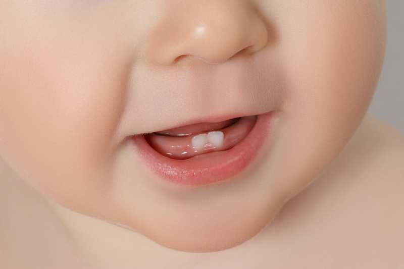 Điều gì có thể diễn ra nếu răng của bé không mọc đúng thời gian?
