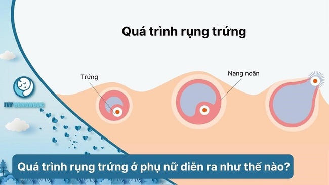 Rụng trứng thường xảy ra vào giữa chu kỳ kinh nguyệt, là hiện tượng trứng được giải phóng khỏi buồng trứng