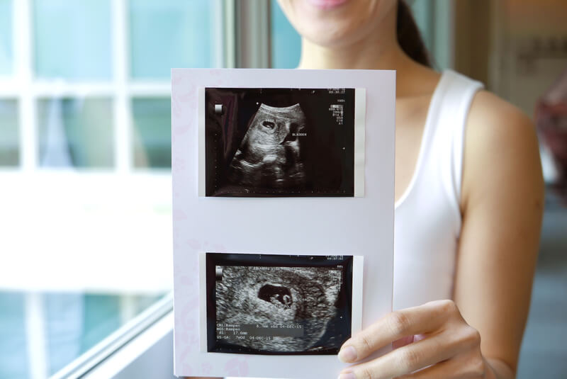 Tại sao quá trình khám thai định kỳ là rất cần thiết với sự phát triển của thai nhi?

