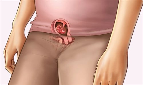 Thai nhi 3 tuần tuổi: Dấu hiệu mang thai, có siêu âm được không ...