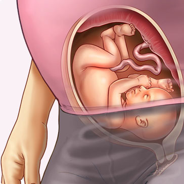 Thiếu sót về bộ phận sinh dục thai nhi 26 tuần và tác động
