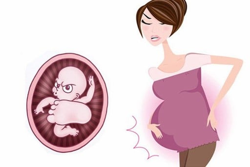 Tại sao em bé gò trong bụng mẹ? Có nguy hiểm không? | Huggies