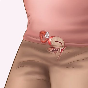  Có thai 3 tuần bụng có to không : Nguyên nhân và cách xử lý
