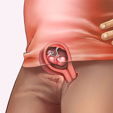 Thay đổi thai nhi 8 tuần: Bạn đã tò mò muốn biết những thay đổi của thai nhi 8 tuần đầu đời của mình như thế nào? Thật tuyệt vời khi nhìn thấy nét đầy quyến rũ của thai nhi đầu tiên của bạn. Hãy xem hình ảnh này để có thể cảm nhận được vẻ đẹp và kỳ diệu của thai nhi đang phát triển trong bụng mẹ.