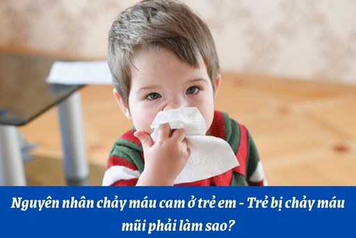 Các bệnh tương tự với chảy máu mũi ở trẻ em là gì? 

