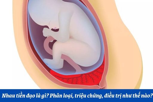 Sau khi phát hiện nhau tiền đạo, bác sĩ sẽ thực hiện những biện pháp gì để đảm bảo an toàn cho thai và mẹ?