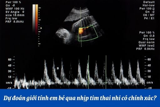 Cách nhận biết giới tính của thai nhi dựa trên nhịp tim?
