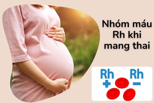 Những rủi ro nếu thai phụ có nhóm máu Rhesus âm (Rh-) và thai nhi có nhóm máu Rhesus dương (Rh+)?
