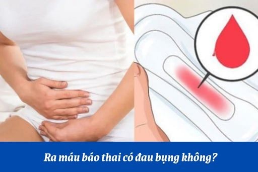 Ra máu báo thai có đau bụng không? Kéo dài trong bao lâu? | Huggies