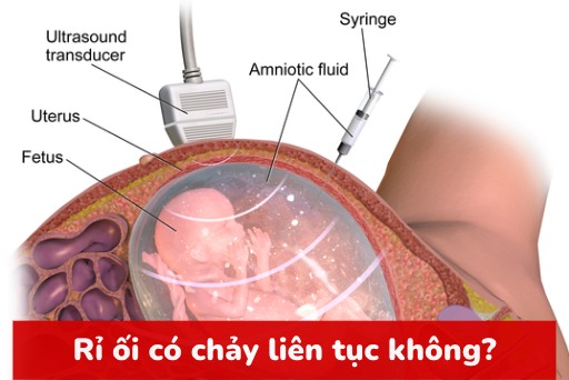 Rỉ ối có hiện tượng như thế nào: Nguyên nhân, Dấu hiệu và Biện pháp