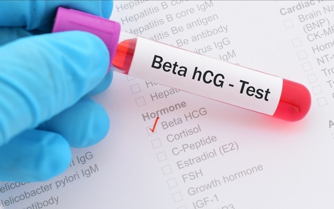 Xét nghiệm beta-hCG