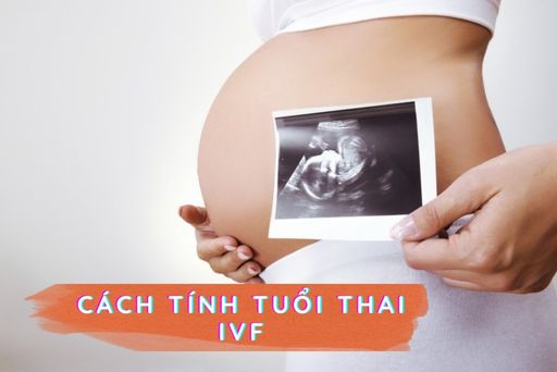 Có cần sử dụng công thức đặc biệt để tính tuổi thai IVF không?
