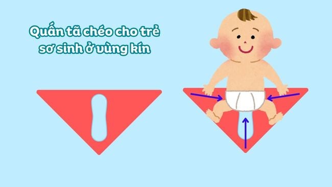 Hướng dẫn cách quấn tã chéo cho trẻ sơ sinh ở vùng kín