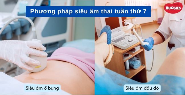 Có 2 phương pháp siêu âm thai 7 tuần tuổi là siêu âm ổ bụng và siêu âm đầu dò