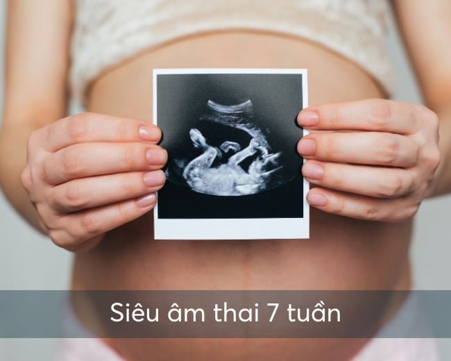 Tìm hiểu về thai 7 tuần kích thước bao nhiêu và những điều quan trọng cần biết cho mẹ bầu