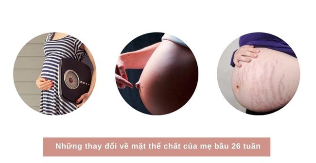 Khi mang thai 26 tuần, một số thay đổi về mặt thể chất sẽ xảy ra với mẹ bầu