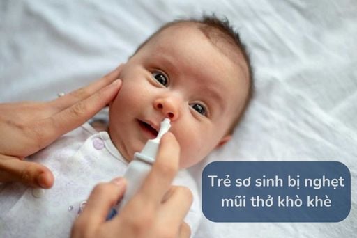 4. Phương Pháp Xử Lý Khi Trẻ Sơ Sinh Bị Nghẹt Mũi